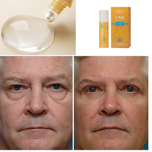 RevitaRoll | Rolon 5 in 1 Ultra Verjongend