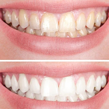 Smiley Tandbleek (Promotie)